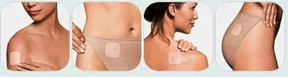 adesivo_contraceptivo_evra